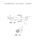 METHOD FOR LEFT ATRIAL APPENDAGE OCCLUSION diagram and image