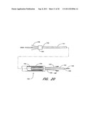 METHOD FOR LEFT ATRIAL APPENDAGE OCCLUSION diagram and image