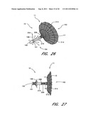 METHOD FOR LEFT ATRIAL APPENDAGE OCCLUSION diagram and image