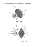 METHOD FOR LEFT ATRIAL APPENDAGE OCCLUSION diagram and image