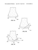 Patient Selectable Joint Arthroplasty Devices and Surgical Tools diagram and image