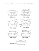 Patient Selectable Joint Arthroplasty Devices and Surgical Tools diagram and image