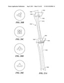 Patient Selectable Joint Arthroplasty Devices and Surgical Tools diagram and image