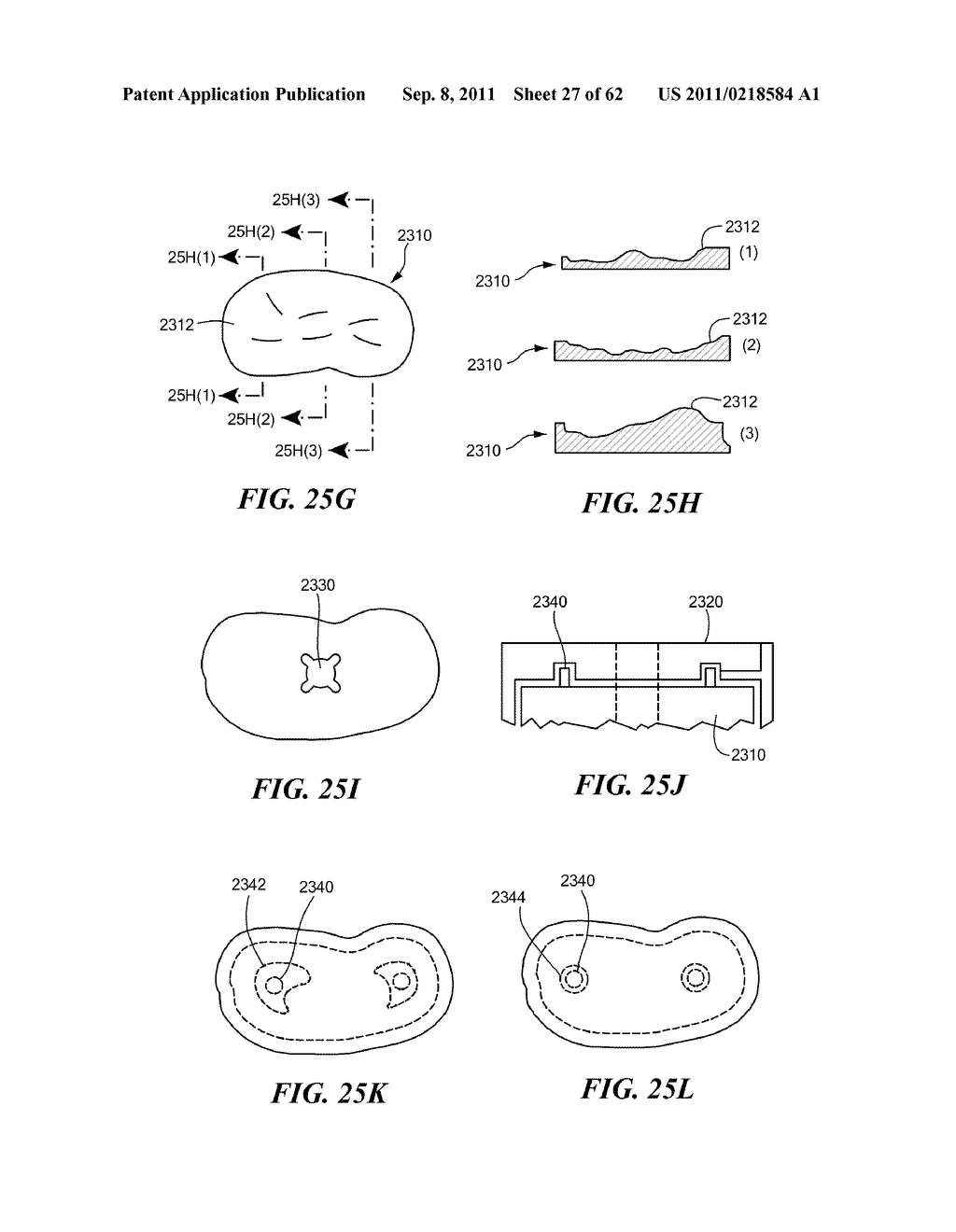 Patient Selectable Joint Arthroplasty Devices and Surgical Tools - diagram, schematic, and image 28