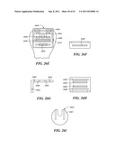 Patient Selectable Joint Arthroplasty Devices and Surgical Tools diagram and image