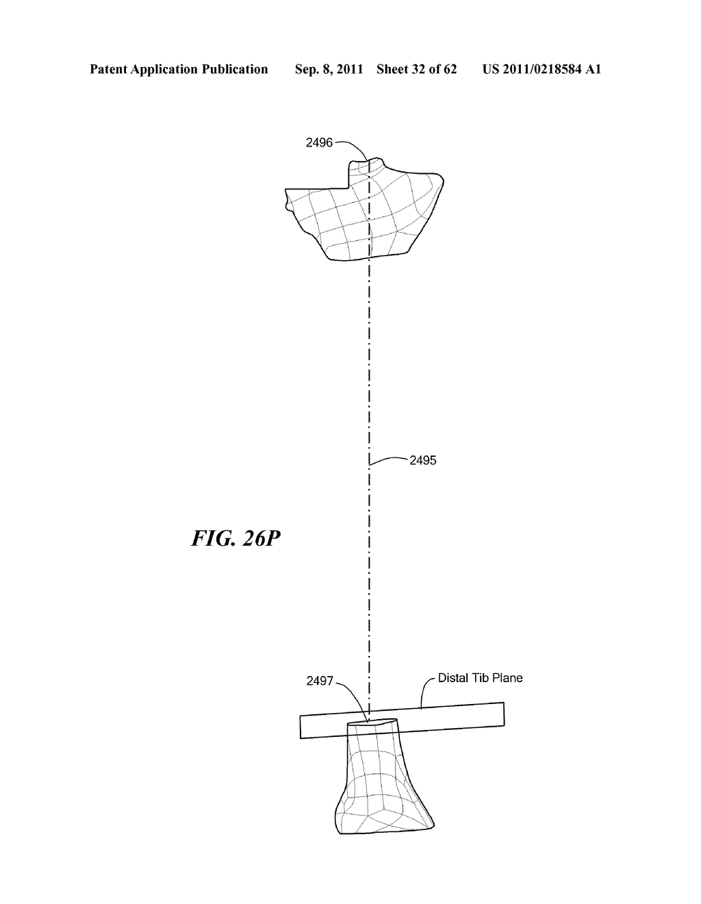 Patient Selectable Joint Arthroplasty Devices and Surgical Tools - diagram, schematic, and image 33