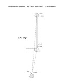 Patient Selectable Joint Arthroplasty Devices and Surgical Tools diagram and image