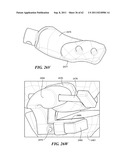 Patient Selectable Joint Arthroplasty Devices and Surgical Tools diagram and image