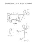 Patient Selectable Joint Arthroplasty Devices and Surgical Tools diagram and image