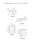 Patient Selectable Joint Arthroplasty Devices and Surgical Tools diagram and image