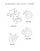 Patient Selectable Joint Arthroplasty Devices and Surgical Tools diagram and image