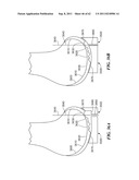 Patient Selectable Joint Arthroplasty Devices and Surgical Tools diagram and image