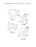 Patient Selectable Joint Arthroplasty Devices and Surgical Tools diagram and image