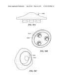 Patient Selectable Joint Arthroplasty Devices and Surgical Tools diagram and image