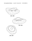 Patient Selectable Joint Arthroplasty Devices and Surgical Tools diagram and image