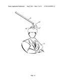 Stand-Alone Scanning Laser Device diagram and image