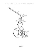 Stand-Alone Scanning Laser Device diagram and image