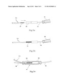 UPGRADEABLE IMPLANTABLE DEVICE diagram and image