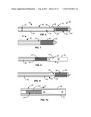 Vascular Prosthesis Assembly with Retention Mechanism and Method diagram and image