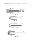 Vascular Prosthesis Assembly with Retention Mechanism and Method diagram and image