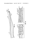 Vascular Prosthesis Assembly with Retention Mechanism and Method diagram and image