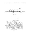 Vascular Prosthesis Assembly with Retention Mechanism and Method diagram and image