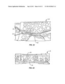 Vascular Prosthesis Assembly with Retention Mechanism and Method diagram and image