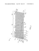 Stent With Multi-Crown Constraint and Method for Ending Helical Wound     Stents diagram and image