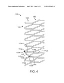 Stent With Multi-Crown Constraint and Method for Ending Helical Wound     Stents diagram and image