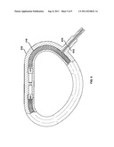 INDUCTION ACTIVATION OF ADJUSTABLE ANNULOPLASTY RINGS AND OTHER     IMPLANTABLE DEVICES diagram and image