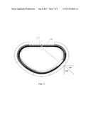 INDUCTION ACTIVATION OF ADJUSTABLE ANNULOPLASTY RINGS AND OTHER     IMPLANTABLE DEVICES diagram and image