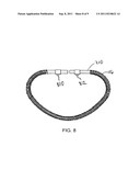 INDUCTION ACTIVATION OF ADJUSTABLE ANNULOPLASTY RINGS AND OTHER     IMPLANTABLE DEVICES diagram and image