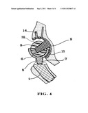 Interlocking reverse hip prosthesis diagram and image