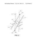 REPOSITIONABLE ENDOLUMINAL SUPPORT STRUCTURE AND ITS APPLICATIONS diagram and image