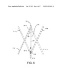 REPOSITIONABLE ENDOLUMINAL SUPPORT STRUCTURE AND ITS APPLICATIONS diagram and image