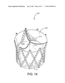 REPOSITIONABLE ENDOLUMINAL SUPPORT STRUCTURE AND ITS APPLICATIONS diagram and image