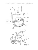 THREE SIDED SHOE HEEL WEAR INSERT diagram and image