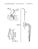 FISHING TRIGGER DEVICE diagram and image