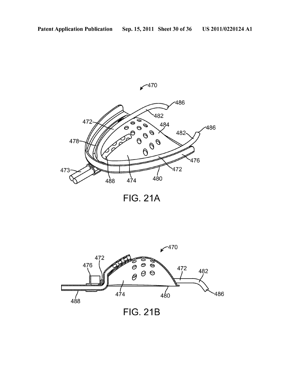 METHODS AND SYSTEMS FOR IMPROVING AIRWAY PATENCY - diagram, schematic, and image 31