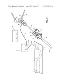 SCANNING CANNULA diagram and image