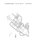 SCANNING CANNULA diagram and image