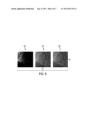 Method and System for Graph Based Interactive Detection of Curve     Structures in 2D Fluoroscopy diagram and image