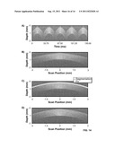 Methods, Systems and Computer Program Products for Distributed Scanning     for Motion Artifact Reduction in Optical Coherence Tomography diagram and image