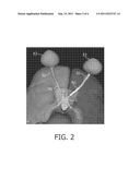 IMAGE CLASSIFICATION BASED ON IMAGE SEGMENTATION diagram and image