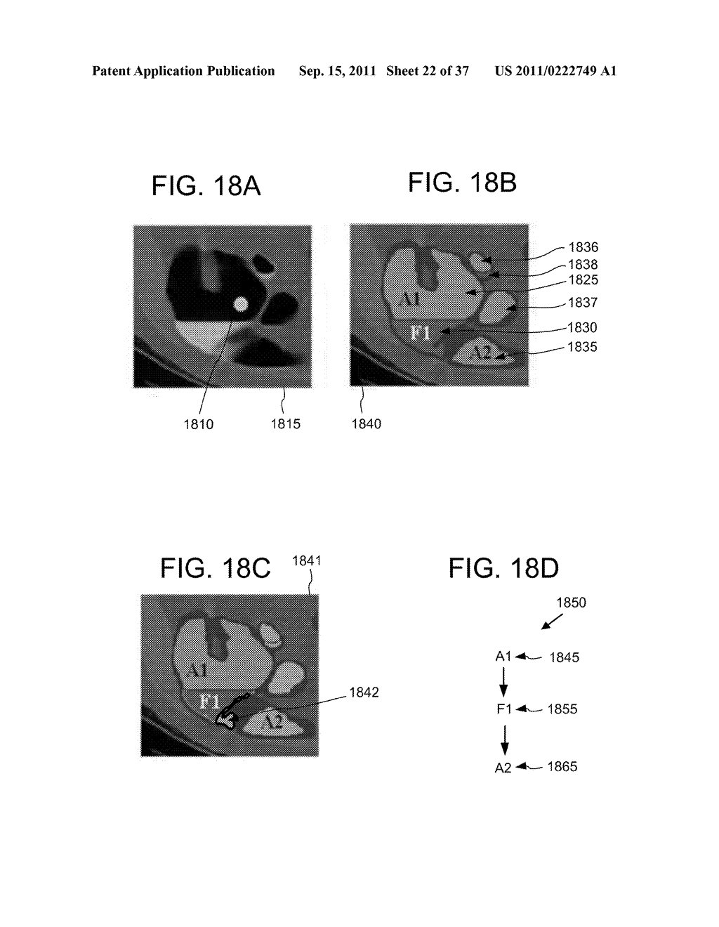 HYBRID SEGMENTATION OF ANATOMICAL STRUCTURE - diagram, schematic, and image 23