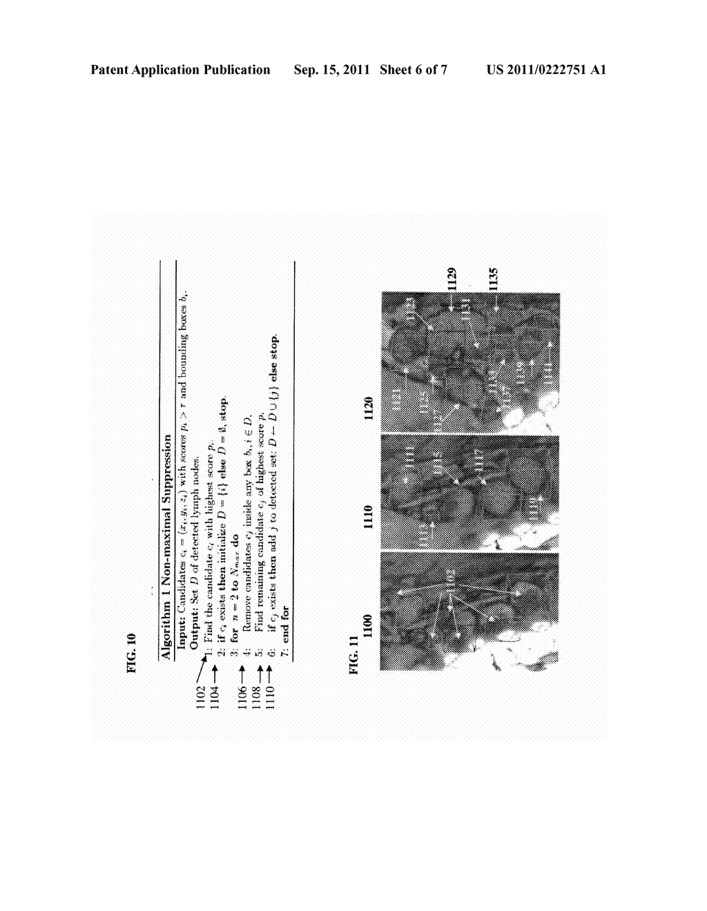 Method and System for Automatic Detection and Segmentation of Axillary     Lymph Nodes - diagram, schematic, and image 07