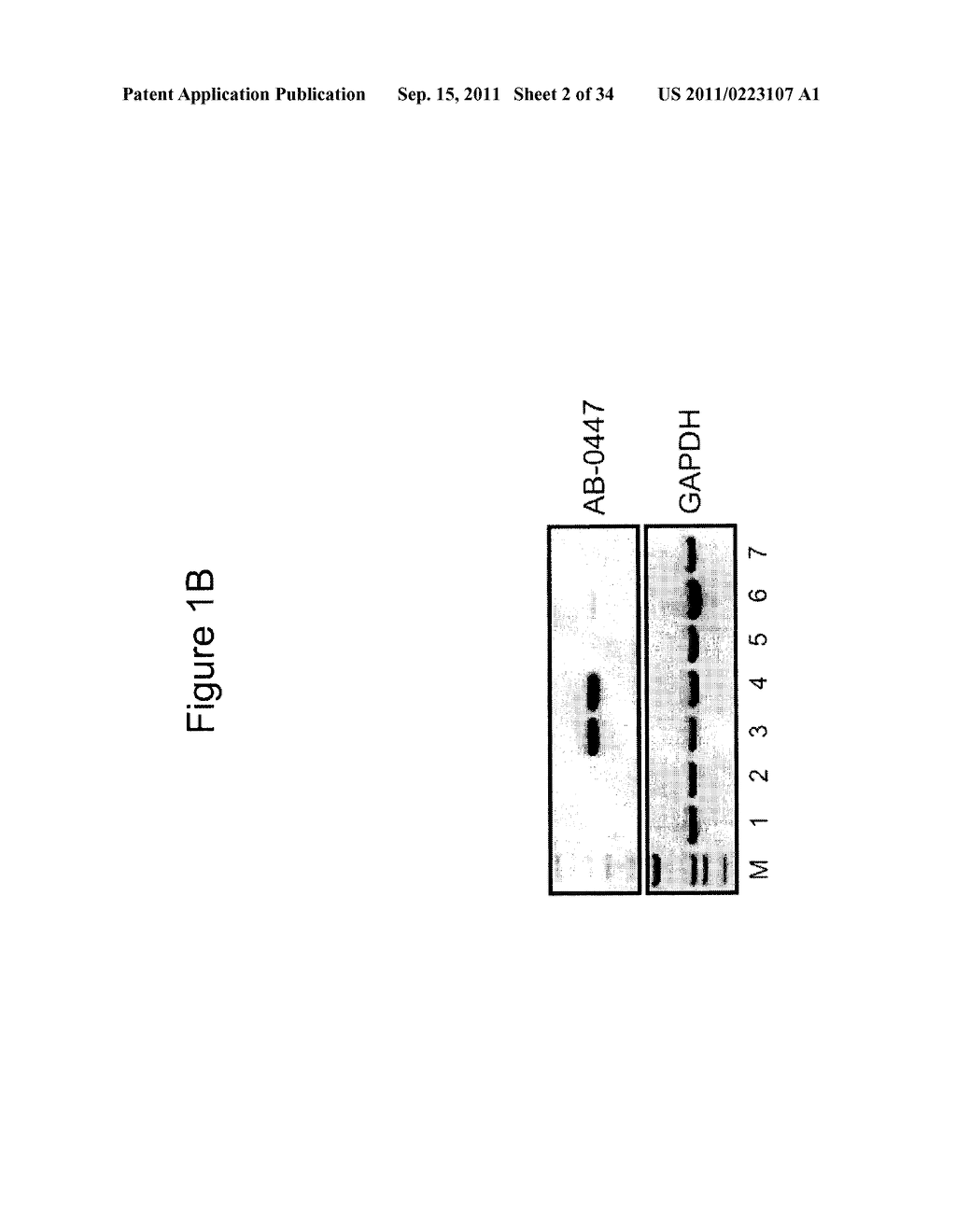 ANTIBODIES THAT SPECIFICALLY BLOCK THE BIOLOGICAL ACTIVITY OF A TUMOR     ANTIGEN - diagram, schematic, and image 03