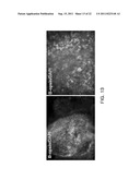 METHOD FOR DIFFERENTIATION INTO RETINAL CELLS FROM STEM CELLS diagram and image