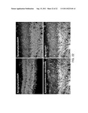 METHOD FOR DIFFERENTIATION INTO RETINAL CELLS FROM STEM CELLS diagram and image