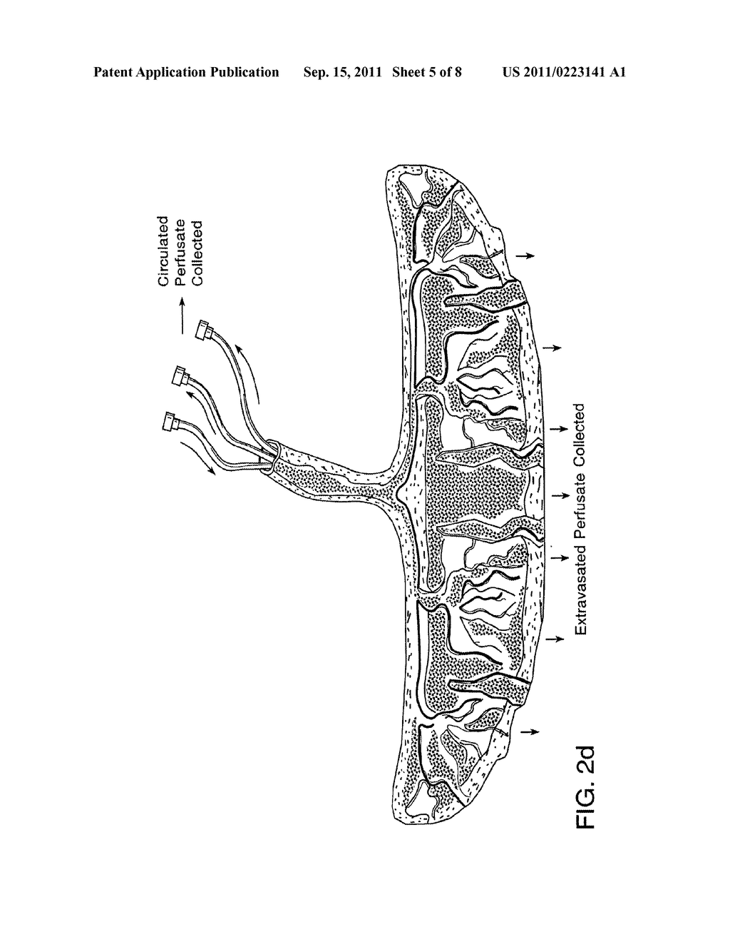 TREATMENT OF BRAIN OR SPINAL CORD INJURY USING PLACENTAL STEM CELLS - diagram, schematic, and image 06